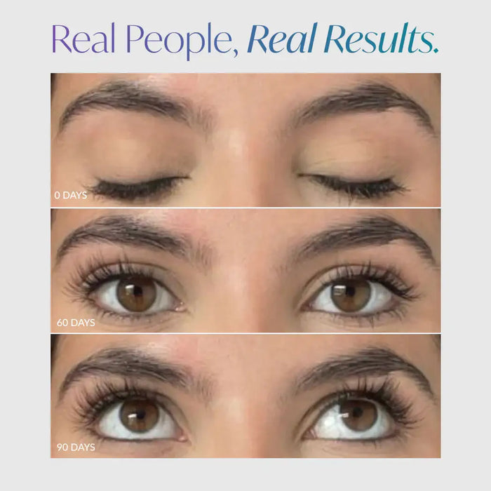 Real results: longer, fuller lashes after 90 days with lash serum